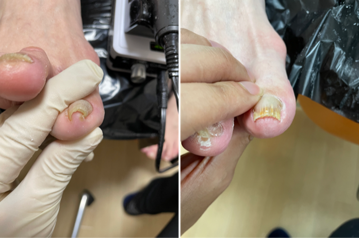 要さんビフォーアフター